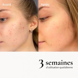 Huile métamorphose démaquillante et réconfortante