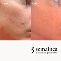 Crème de mousse exfoliante